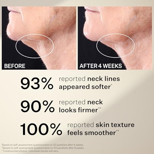 StriVectin Tighten and Lift Peptight Face Lift Serum with Tightening and Brightening Peptides for Wrinkles