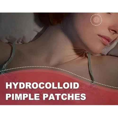 Acne Patches, 360 Count, Hydrocolloid Pimple Stickers, Breathable, Alcohol-Free, All Skin Types