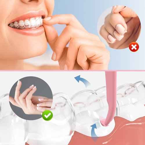 ARGOMAX - Aligner Removal Tool, 50 Retainer Remover Tool, Invisible Braces Removal Tools, Suitable for Removing Braces, Trays, Retainers, Dentures and Aligners(Pink).