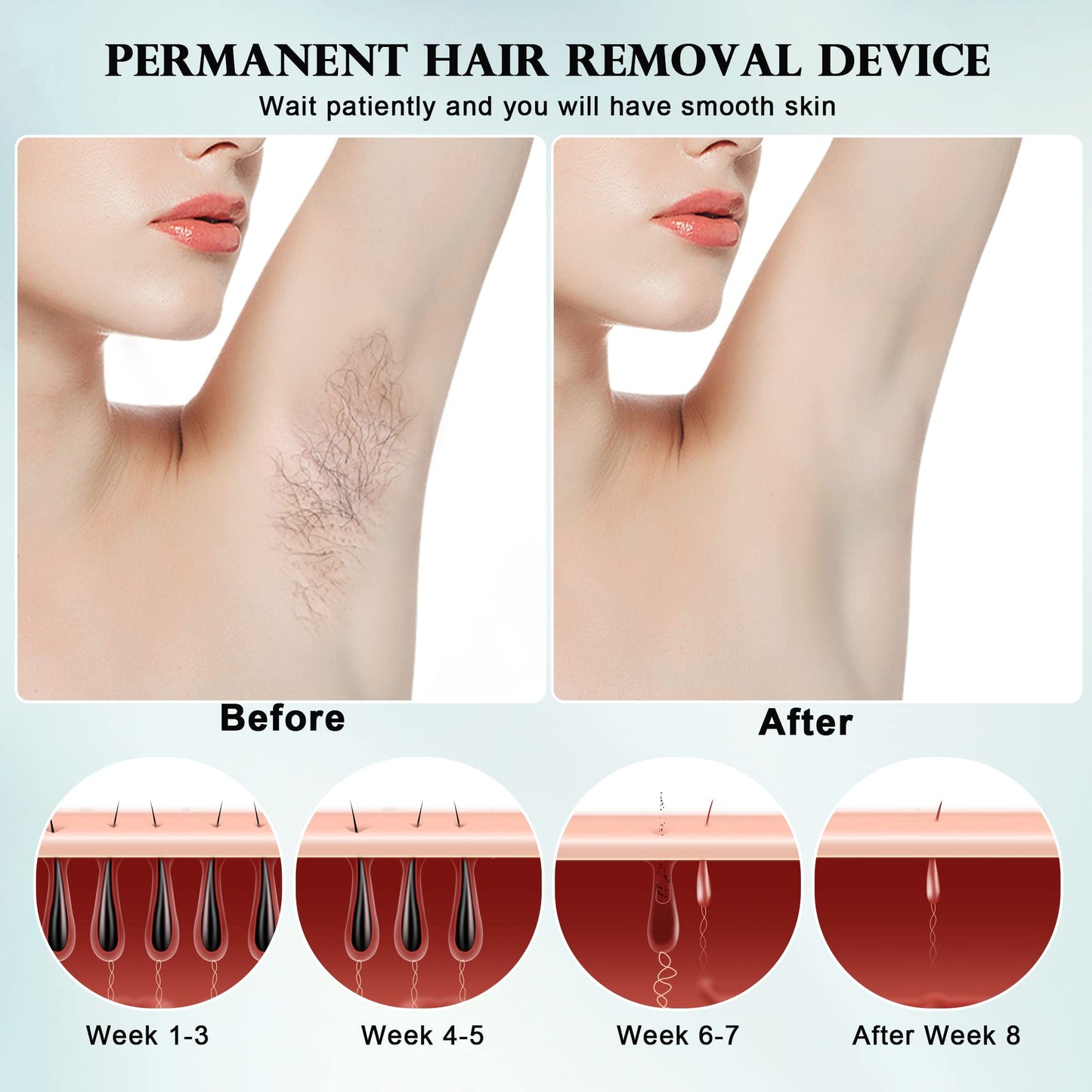 DEESS IPL Laser Hair Removal for Women & Men, GP590 Unlimited Flashes Laser Hair Removal Device with Ice Cooling, 3-in-1 at Home Painless Permanent Hair Remover for Face Arms Armpits Legs Bikini Body
