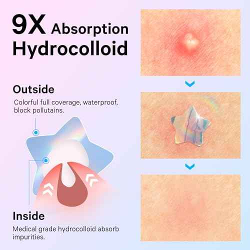 Sosky Hologram Pimple Patches for Face, Hydrocolloid Acne Patches with Salicylic Acid, Cute Star Zit Stickers,Colorful Blemish Covers,36 Count Blue Pink Star Heart Cloud