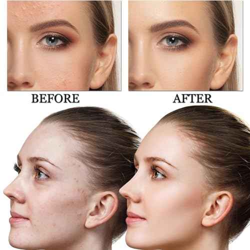 CAHIUYOA Mushroom Head Air Cushion CC Cream BB Cream Mushroom Head Foundation Full Coverage Foundation Makeup Long Lasting Moisturize Matte Concealer - 03 Medium