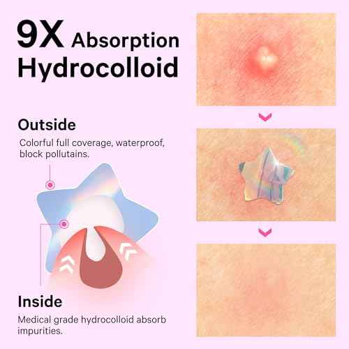Sosky Hologram Pimple Patches for Face, Hydrocolloid Acne Patches with Salicylic Acid, Cute Star Zit Stickers,Colorful Blemish Covers,48 Count Pink Flower
