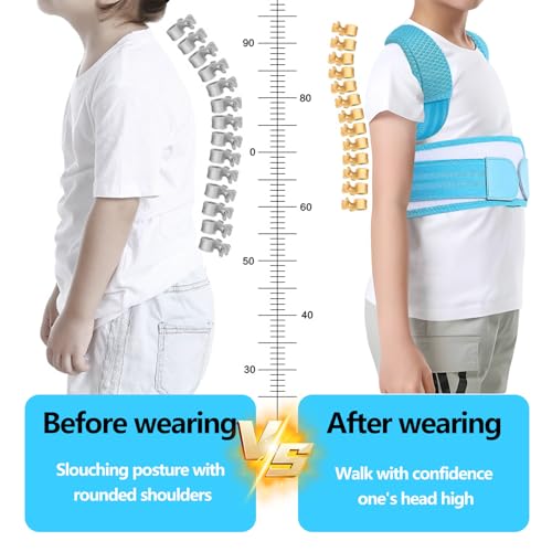 Posture Corrector for Kids,Adjustable Children Posture Corrector for Boys/Girls,Breathable Back Support Belt with Spine Lumbar Shoulder Braces for Hunchback，Spine Corrector (Blue, X-Large)