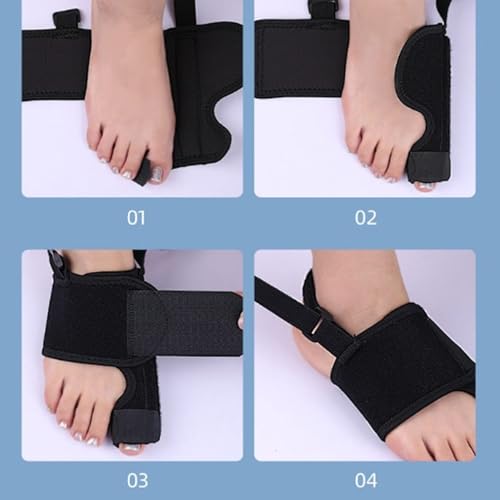 Recovist Bunion Brace, 2025 New Recovist Bunion Brace For Women, Adjustable Orthopedic Splint For Hallux Valgus Correction, Advanced Alignment Technology, Just 20 Minutes A Day (Right)