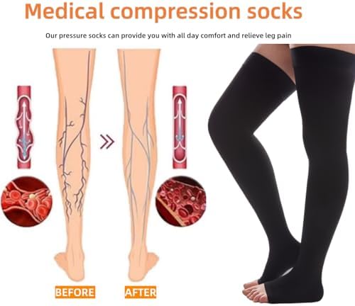 20-30 mmHg Compression Stockings for Women and Men, Open Toe Thigh High Compression Socks, Best Support for Varicose Veins, Edema, DVT