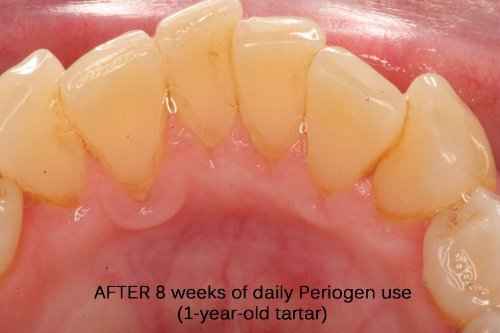 Periogen Complete Oral Health Rinse (3-PK)