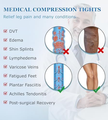 MGANG Medical Compression Pantyhose for Women & Men, 15-20mmHg Graduated Compression Support Tights, Open Toe, Opaque Waist High Compression Stockings for Edema, Varicose Veins, Flight, DVT, Beige XL