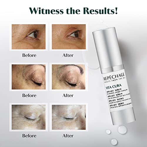 Repechage Vita Cura Opti-Lift Serum ? Lightweight, Smoothing Serum for Eyes & Targeted Areas, Helps Lift & Refine Skin Texture ? for Puffiness, Fine Lines & Under-Eye Shadows (15 mL / 0.5 fl oz)