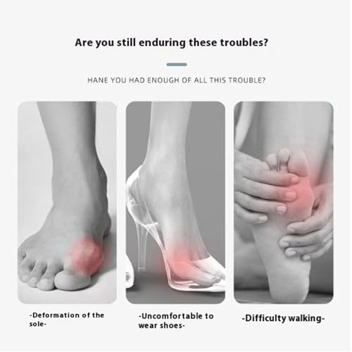 Recovist Bunion Brace, 2025 New Recovist Bunion Brace For Women, Adjustable Orthopedic Splint For Hallux Valgus Correction, Advanced Alignment Technology, Just 20 Minutes A Day (Right)