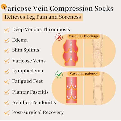 20-30mmhg Thigh High Compression Socks, Compression Stockings For Women & Men, Closed Toe Compression Socks For Varicose Veins,Edema,Beige Black