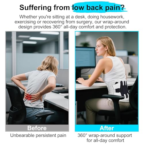 Back Brace for Lower Back Pain, Lumbar Support Belt for Women and Men with Lumbar Pad, Lower Back Brace with Adjustable Strap for Work, Herniated Disc, Sciatica, Scoliosis (Gray, Small)