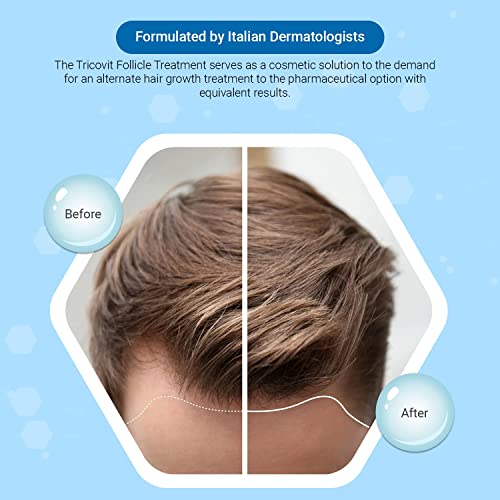 Tricovit Tablets and Forte Hair Lotion Serum Set - With Androgen and DHT Blockers For Thinning Hair - Promotes Stronger, Thicker Hair For Men and Women - 10 Ampoules