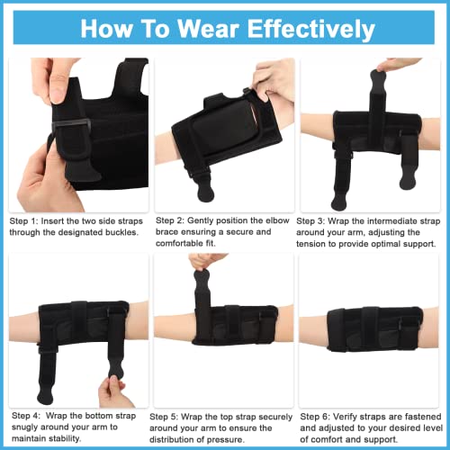 Elbow Splint Tendonitis Elbow Brace, Cubital Tunnel Syndrome Brace with 4 Removable Metal Spring Splints for Sleeping, Elbow Immobilizer for Ulnar Nerve Entrapment， Golfers Elbow (S/M)