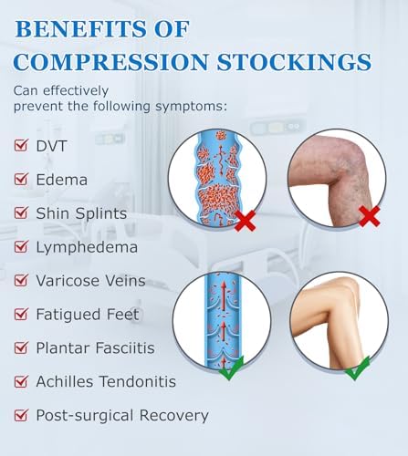 MGANG Medical 20-30 mmHg Compression Stockings for Women & Men, Pair, Thigh High Graduated Compression Socks, Closed Toe, Opaque, Support for Varicose Veins, Edema, DVT, Swelling, Flight, Black XL