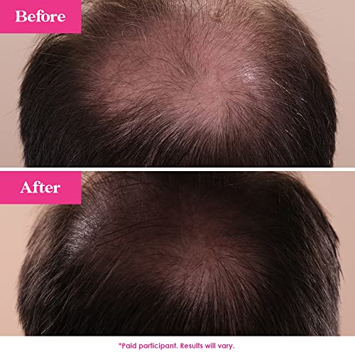 Grande Cosmetics GrandeHAIR Hair Enhancing Serum for Men and Women, Promotes Thickness in Thinning Hair, Safe for Color Treated Hair