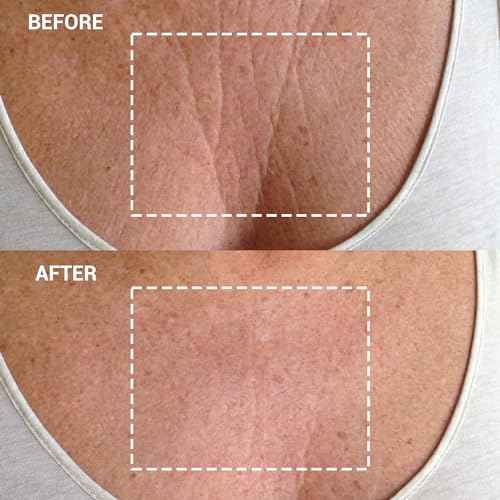 Wrinkles Schminkles Chest Wrinkle Patch - Reusable Silicone Smoothing Pads for Cleavage & Body, Reduce Wrinkles & Stretch Marks, Sensitive Formulated, Secret to Radiant Skin (1 Pack)