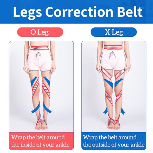 GHORTHOUD O/X Legs Correction Belt Legs Posture Corrector Band Unisex O/X Legs Bandage Lightweight Pediatric Straighten Belt for Men Women and Children（Large）