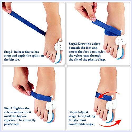 Bunion Corrector Brace for Pain Relief, Hallux Valgus Corrector & Big Toe Joint Support – Adjustable Night Splint for Men and Women, Comfortable Bunion Valgus Protective Cover (2Pcs)