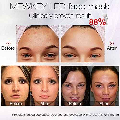 NEWKEY Blue light Therapy Mask for Face Acne, 7 Colors LED Acne Scar Spots Light Therapy Treatment with Silicone Eye Protector for Acne Prone Sensitive Skin and Blemishes Prevention,Plug-in