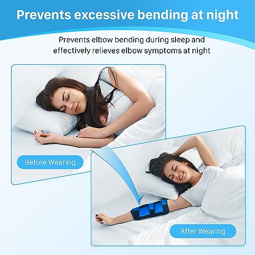 Cubital Tunnel Elbow Splint, Ulnar Nerve Night Brace, for Women & Men, Arm Elbow Splint Support for Left and Right, Built-in 3 Support Plates -L/XL