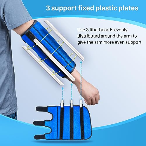 Cubital Tunnel Elbow Splint, Ulnar Nerve Night Brace, for Women & Men, Arm Elbow Splint Support for Left and Right, Built-in 3 Support Plates -L/XL