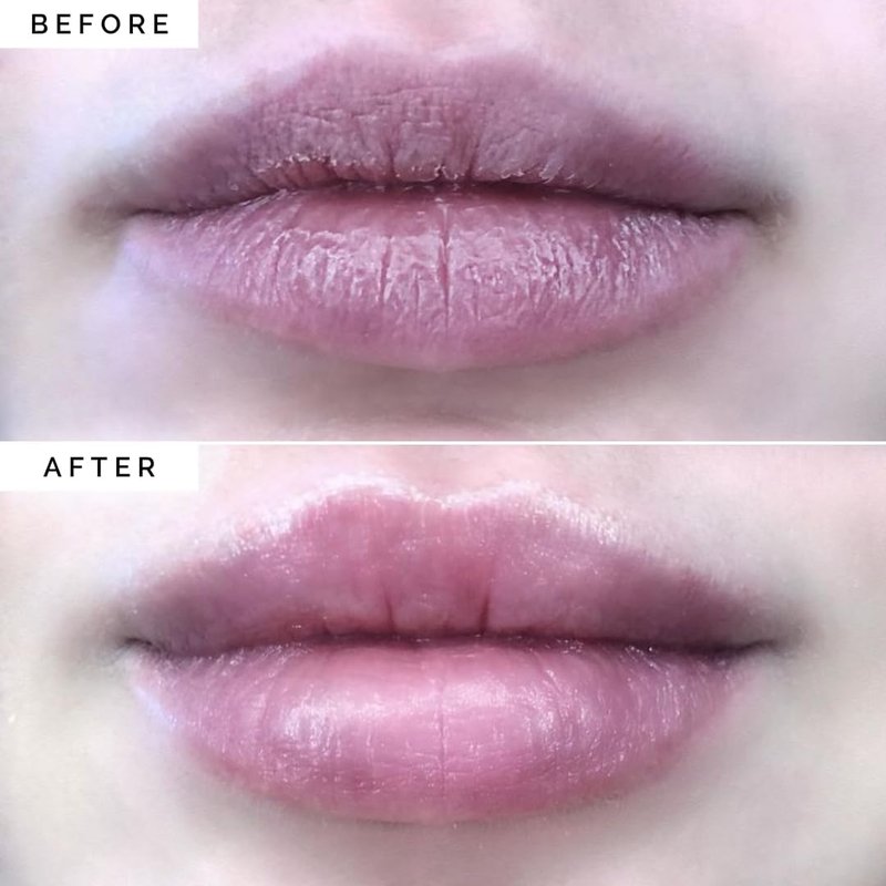 Elizabeth Mott Lip Sleeping Mask – Overnight Treatment with Peptides to Repair, Hydrate & Restore Dry, Chapped, Cracked, Peeling Lips – Moisturizing Collagen Balm to Soften, Smooth, Plump 0.71 oz