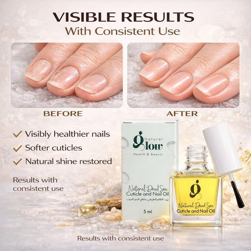 Dead Sea Cuticle & Nail Oil 5ml | Strengthens Nails & Deeply Moisturizes Dry, Cracked Cuticles | With Jojoba, Argan, Olive, Almond & Castor Oils + Vitamin E | Nail Repair & Growth Treatment