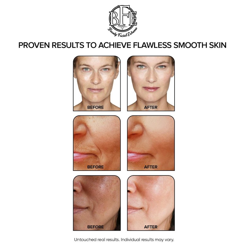 Anti-Aging Resurfacing Peel Pads - Contains Lactic, Salicylic, & Glycolic Acid. Reduces fine Lines, Wrinkles, Dark Spots, Freckles & Uneven Skin Tone. Restore Skin for Smoother & Radiant Complexion.