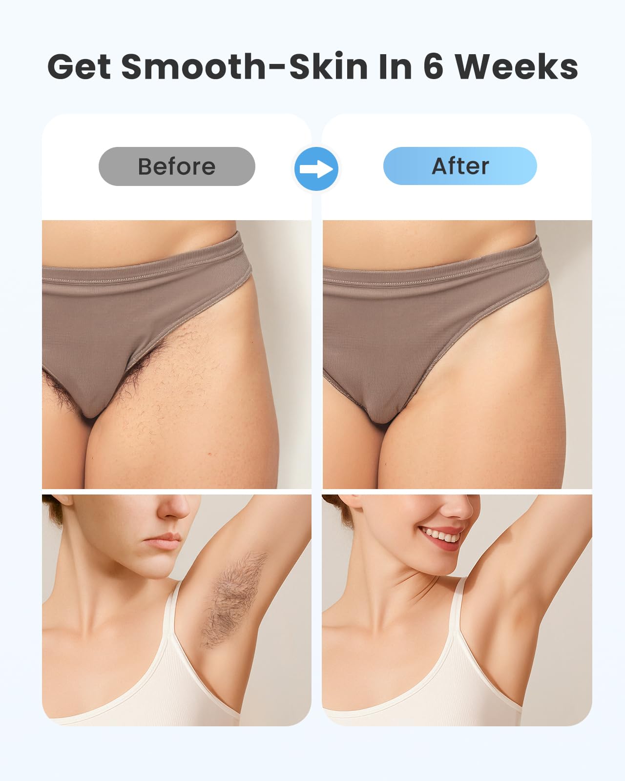 Laser Hair Removal for Women and Men - 5.2 cm² Contact Nearly Painless, Powerful Long-Lasting IPL Hair Removal at-home, Effective in 14 Days with Ultra-fast Light Emission for Whole Body Use,Bule