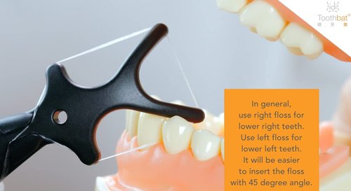 idi Toothbat - Wow Adult Floss Holder (Green/White/Black)-Patented Design Awards Winning Product, Easy, Comfort & Effective, Works Perfectly with Reach Waxed Nylon Floss (Green,White,Black)