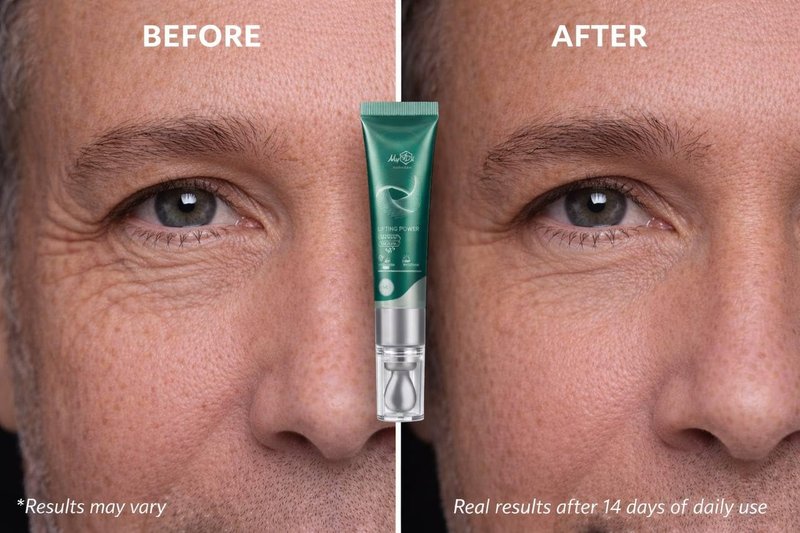 MyIDi Lifting Power Eye Fluid – Eyelid Lifting Treatment for Hooded Eyes & Fine Lines – Multi-Peptide Eye Serum with Ceramide NG, Hyaluronic Acid & Palmitoyl Tripeptide-1 – 0.5 fl oz / 15 ml