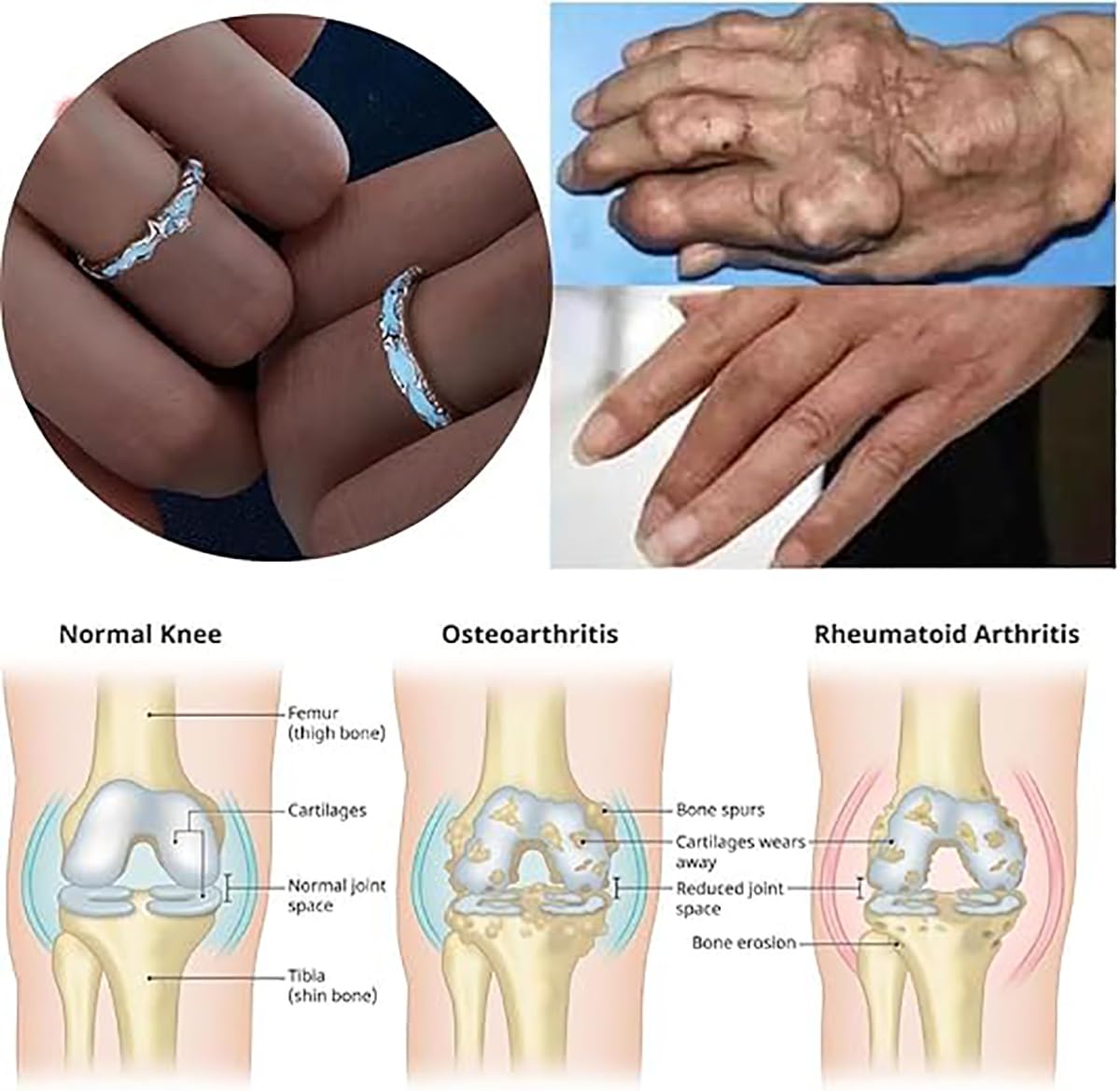IMMUNOTRAX Magnetic Therapy Luminous Titanium Ion Adjustable Ring - Lymphatic Magtherapy Luminous Jewelry for Couples,Glow-in-Dark Wellness Ring Gift for Men/Women (B For Man)