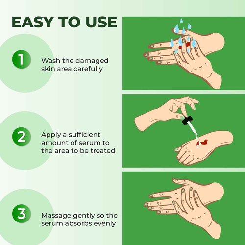 ABERA Alan Silver Serum – Botanical Hydrating Serum for Dry & Sensitive Skin & Herbal Extracts – Daily Moisturizer for Face, Body & Scalp – Fast Absorbing, Lightweight – (2 boxes)