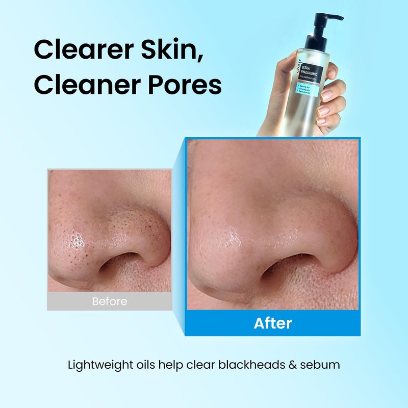 coxir Ultra Hyaluronic Cleansing Oil - Hydrating Korean Oil Cleanser & Makeup Remover for Face, Gentle Fragrance-Free Formula for Dry&Sensitive Skin, Non-Comedogenic [150ml / 5.07 fl.oz]