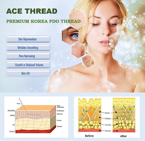ACE PDO Threads Lift/Made in KOREA - Multi Thread Type/L-Type Blunt for Face Lift (16pcs) (23G38mm), Blue