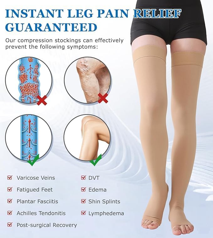 MGANG Medical Thigh High Compression Stockings for Men & Women, Pair, Open Toe, 20-30 mmHg Graduated Compression Support Hose, Opaque, Best for Varicose Veins, Edema, Flight, DVT, Swelling, Beige L