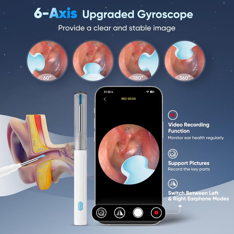 MOOPHY Ear Wax Removal Tool with Camera, 1296P HD Ear Cleaner with 6 LED Lights, Wireless Otoscope Earwax Removal Kit with Silicone Tips & Ear Spoons, Ear Camera for iPhone, iPad & Android, White
