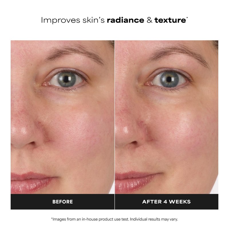 Paula's Choice Skin Balancing Pore-Reducing Face Toner with Niacinamide for Combination & Oily Skin, Minimizes Large Pores, Controls Oil & Shine, Acne-Prone Friendly, Travel Size, 1 Fl Oz