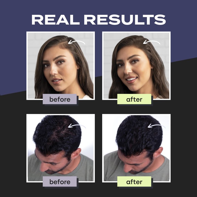 Toppik Hair Building Fibers, White, 12g Fill In Fine or Thinning Hair, Instantly Thicker, Fuller Looking, 9 Shades for Men & Women, Keratin Protein Formula