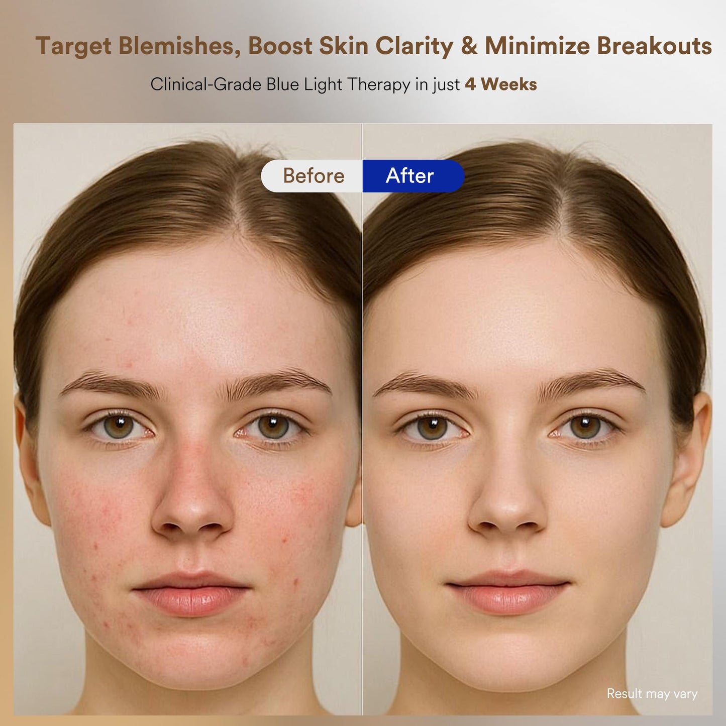 Red Light Therapy for Face, Red, Blue and Near-Infrared Light Therapy Mask for Face, Anti-Wrinkles & Facial Skincare, Portable & Rechargeable, LED Face Mask Light Therapy for Fine Lines and Blemishes.