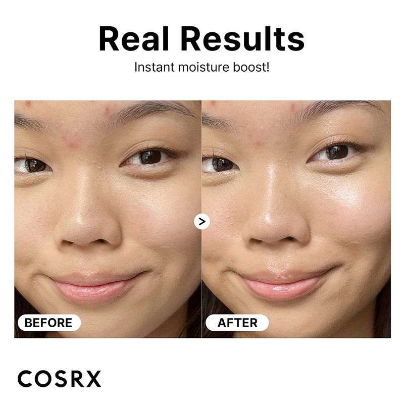 COSRX Hyaluronic Acid 3% Serum, Ceramide, Unisex Skin Serum, Dry Skin