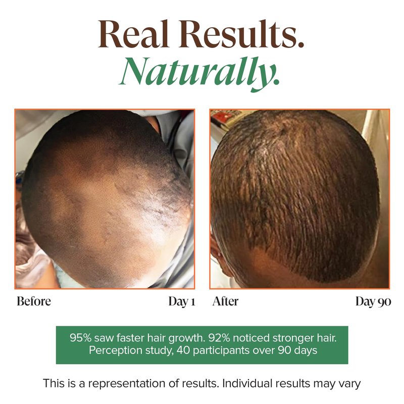Kreyol Essence - Haitian Black Castor Oil for Skin and Hair, Glass Bottle - Cold Pressed, Hexane Free, Fuller-Looking Hair, Natural Humectant, Mango Papaya & Coconut, 3.4 Fl Oz