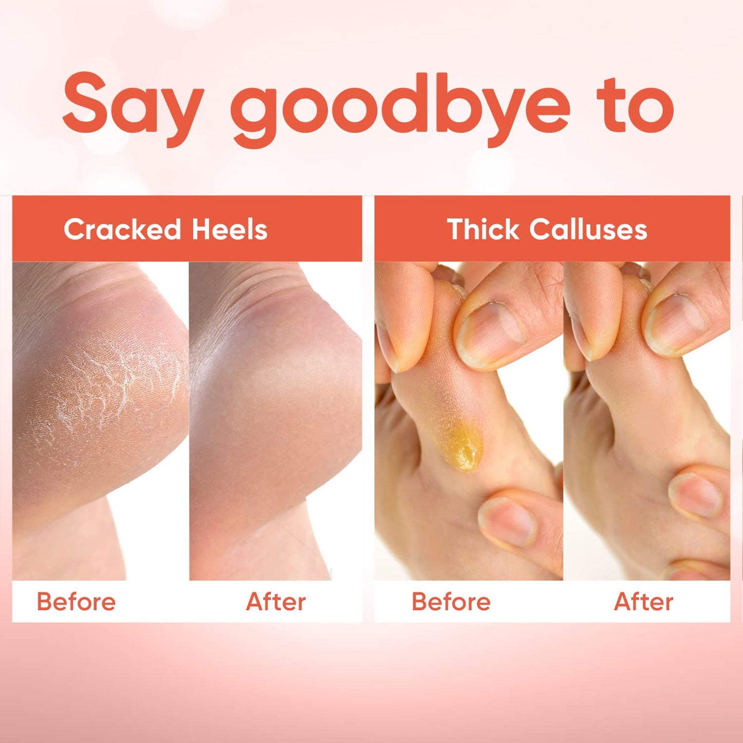 CÉLOR Foot Peeling Mask for Dry Cracked Feet | Foot Mask to Exfoliate Rough, Cracked, Dry Feet, Calluses for Soft Baby Feet Results | Made with Aloe Vera Extract for Women & Men (2 Pairs) | Peach
