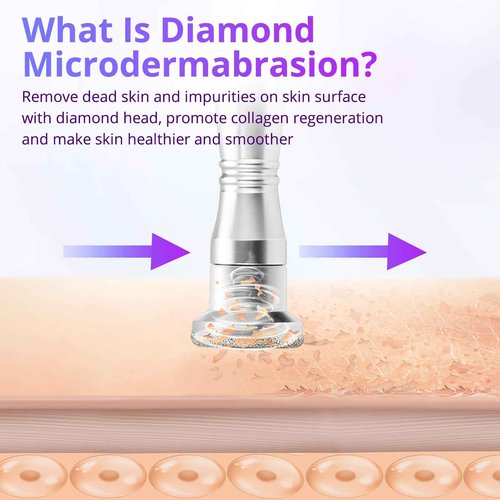 UNOISETION Microdermabrasion Machine with Diamond Tips Kit and 50pcs Cotton Filters