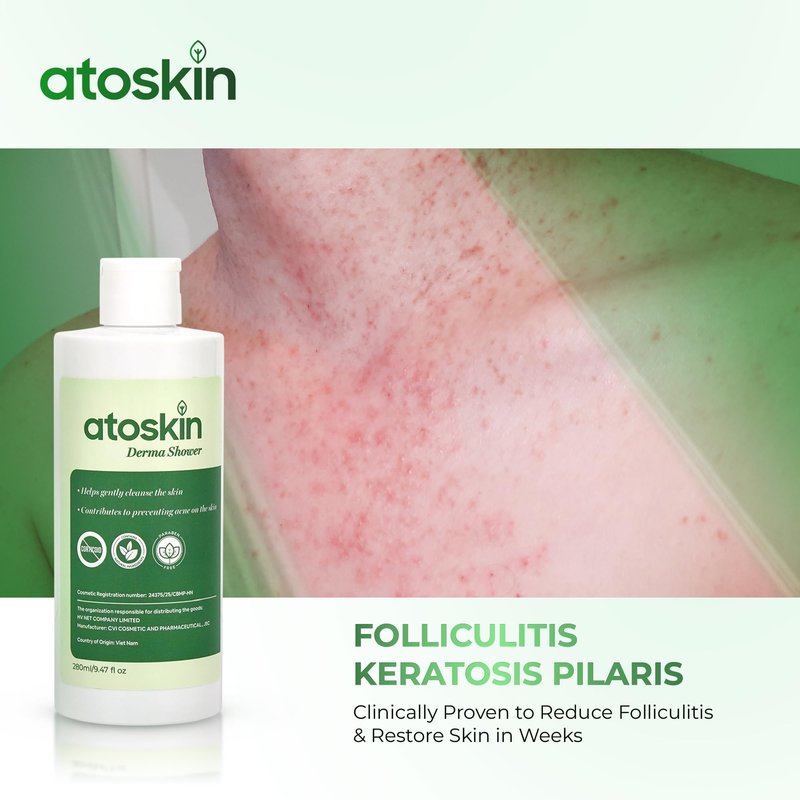 Atoskin Derma Shower – Advanced Folliculitis Body Wash with Rosemary & Ricobio JA7 Herbal Extracts, Reduce Back Acne & Keratosis Pilaris, Gentle Formula for Sensitive Skin (9.47 oz)