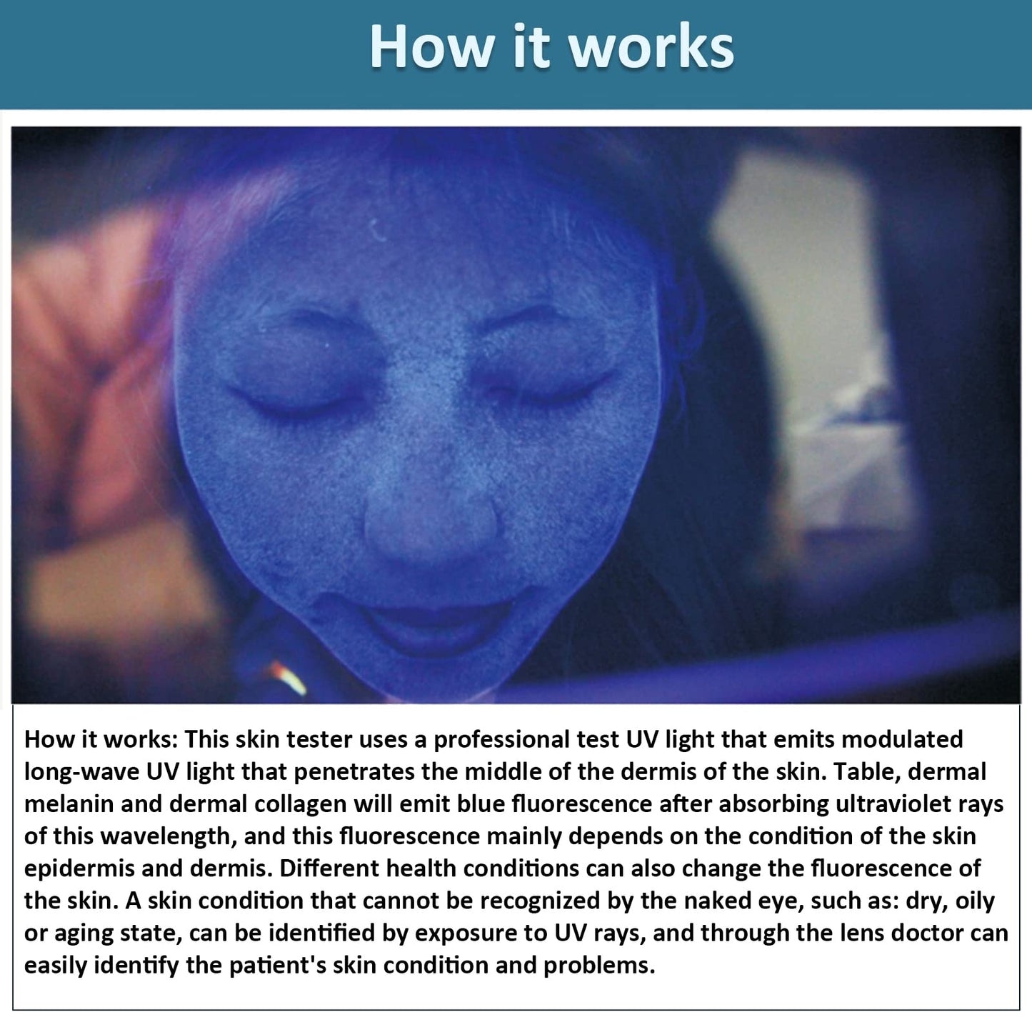 Elitzia ETD1029 Laptop Computer Type UV Beauty Cold Light Skin Analyzer