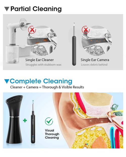 Ear Wax Removal Kit with Camera – Ear Cleaner Tool for Safe & Effective Ear Care – Includes Ear Camera for Visual Inspection & Gentle Ear Irrigation System – Complete Ear Cleaning Solution