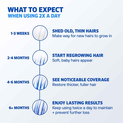 Rogaine Men’s 5% Minoxidil Foam Hair Regrowth Treatment, FDA Approved Brand, Proven to Improve Hair Regrowth, Extra Strength Minoxidil Foam, Unscented Aerosol, 4 Month Supply (4 x 2.11 oz Cans)