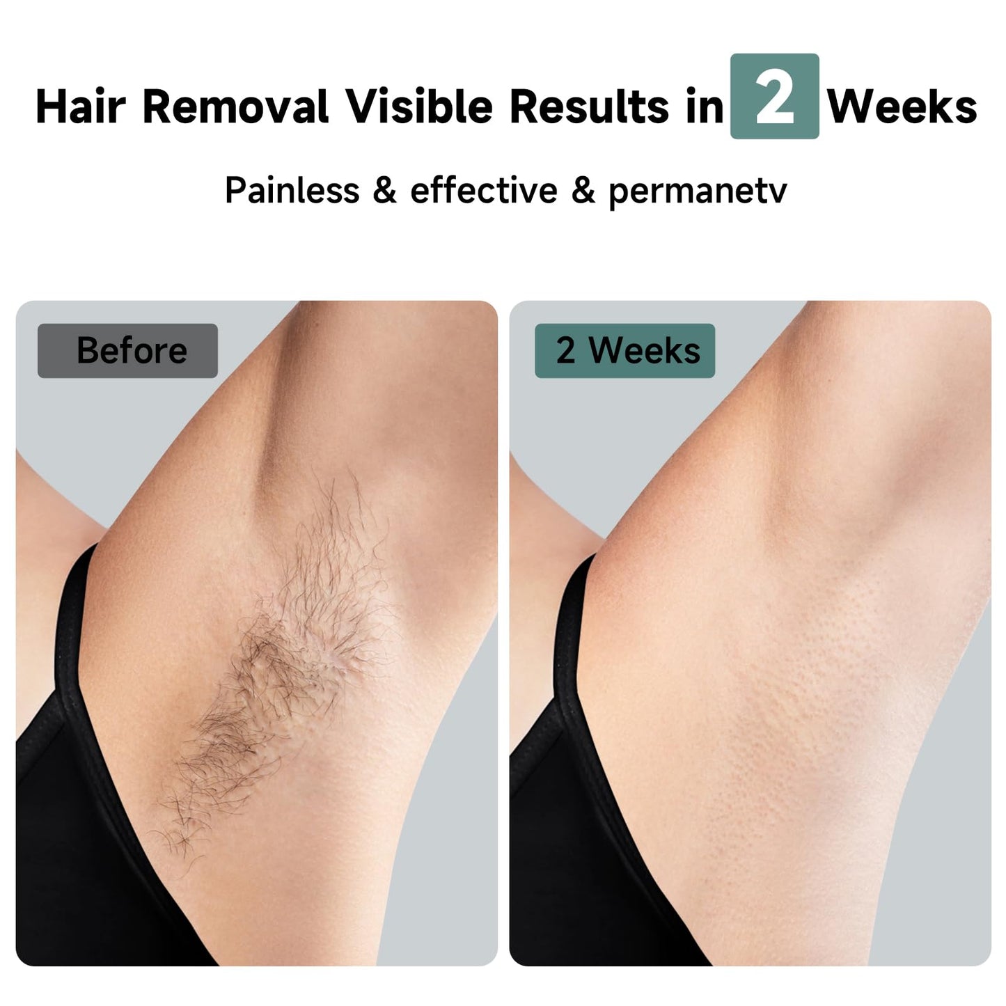 JOVS Laser Hair Removal, 37°F Painless Hair Removal Device with Sapphire Ice-Cooling, 3 in 1 Hair Removal & Skin Rejuvenation for Women and Men, 8 Modes Skin Care for Whole Body, Touch Screen